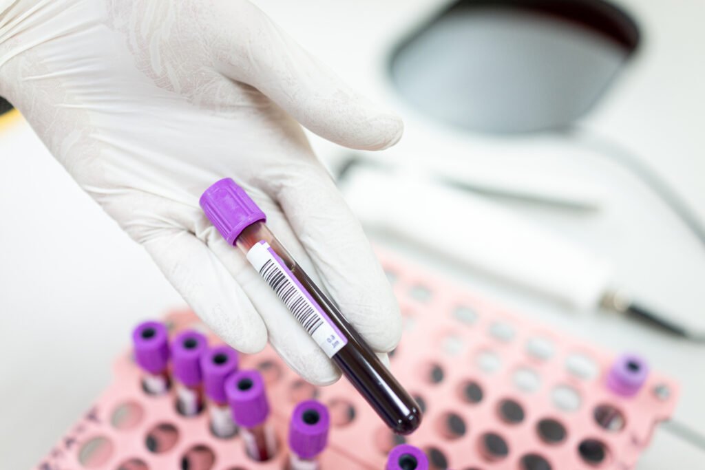 Hospital samples of donated blood